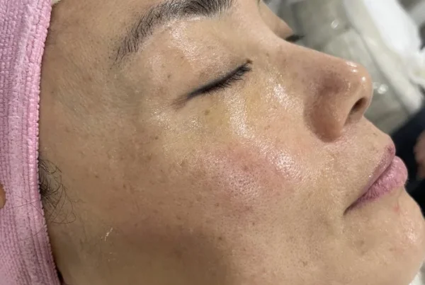 Student practicing a professional facial treatment during esthetics training